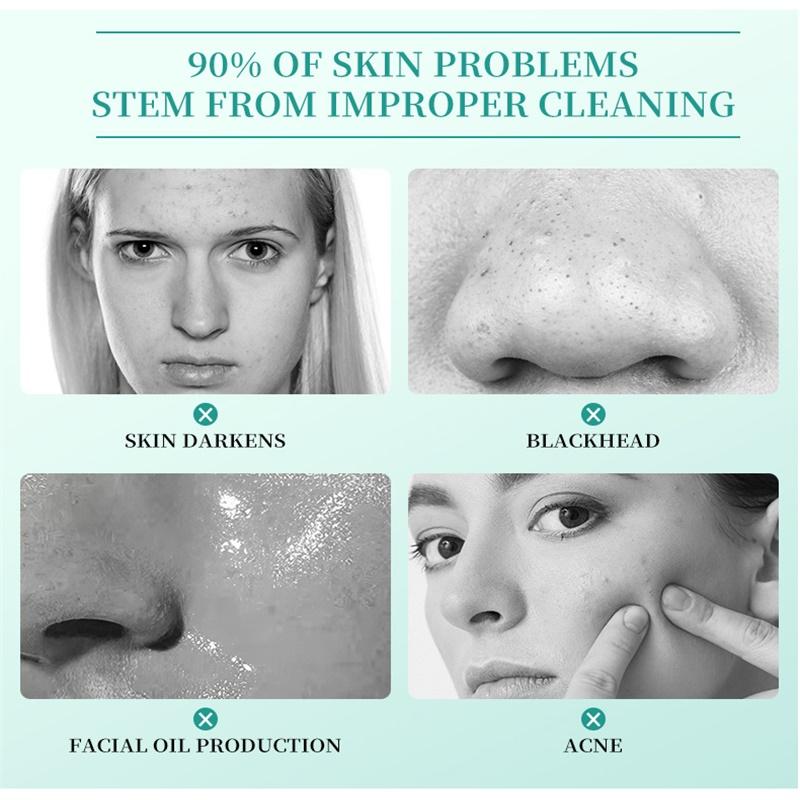 Plant Extract Acne Removal Cream Anti-Acne Repair Redness Pimple Spots Deep Cleaning Pore Oil Control Moisturizing Skin Care
