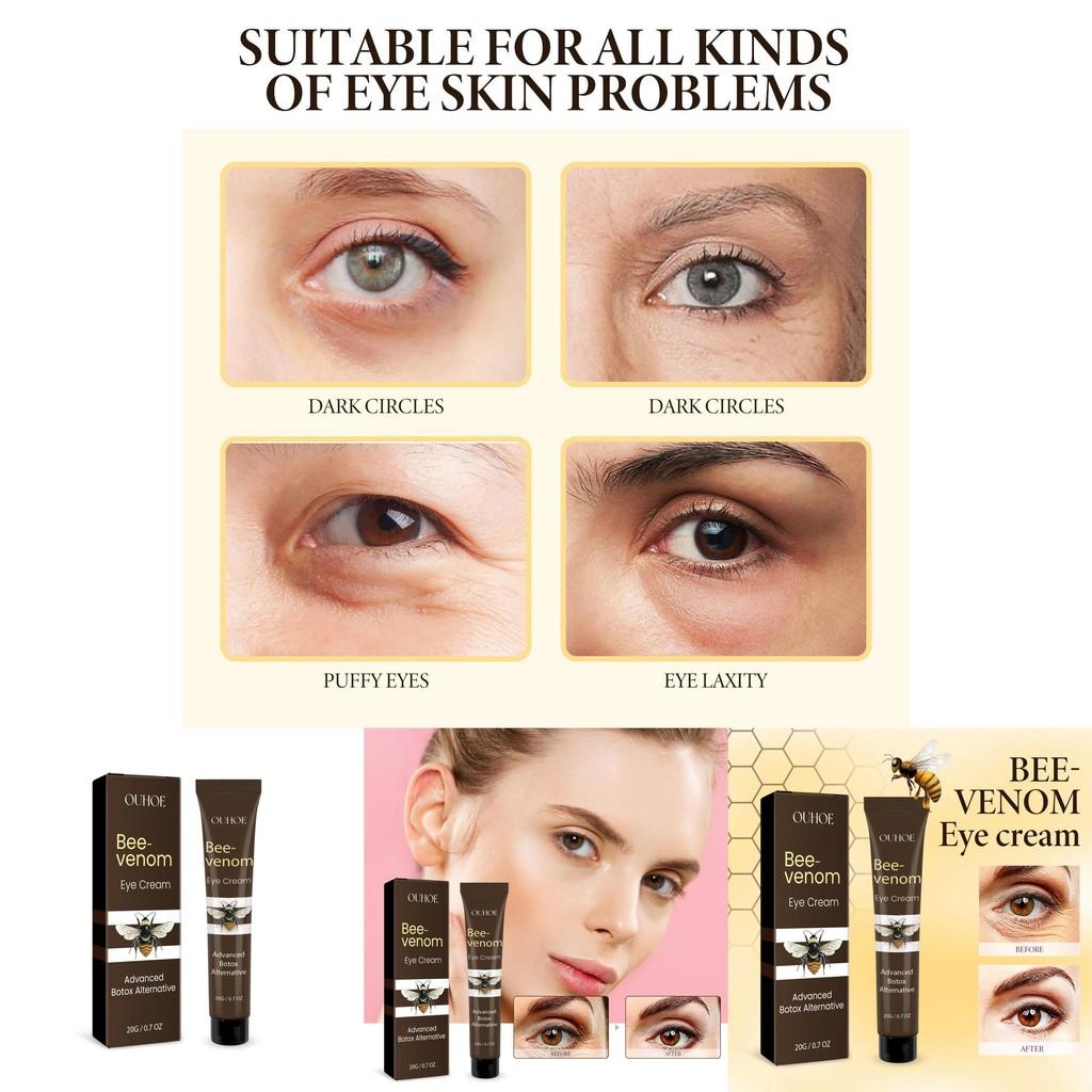 Ouhoe Bee Venom Firming Eye Cream Hydrating Anti-aging Moisturizer For Delicate Skin