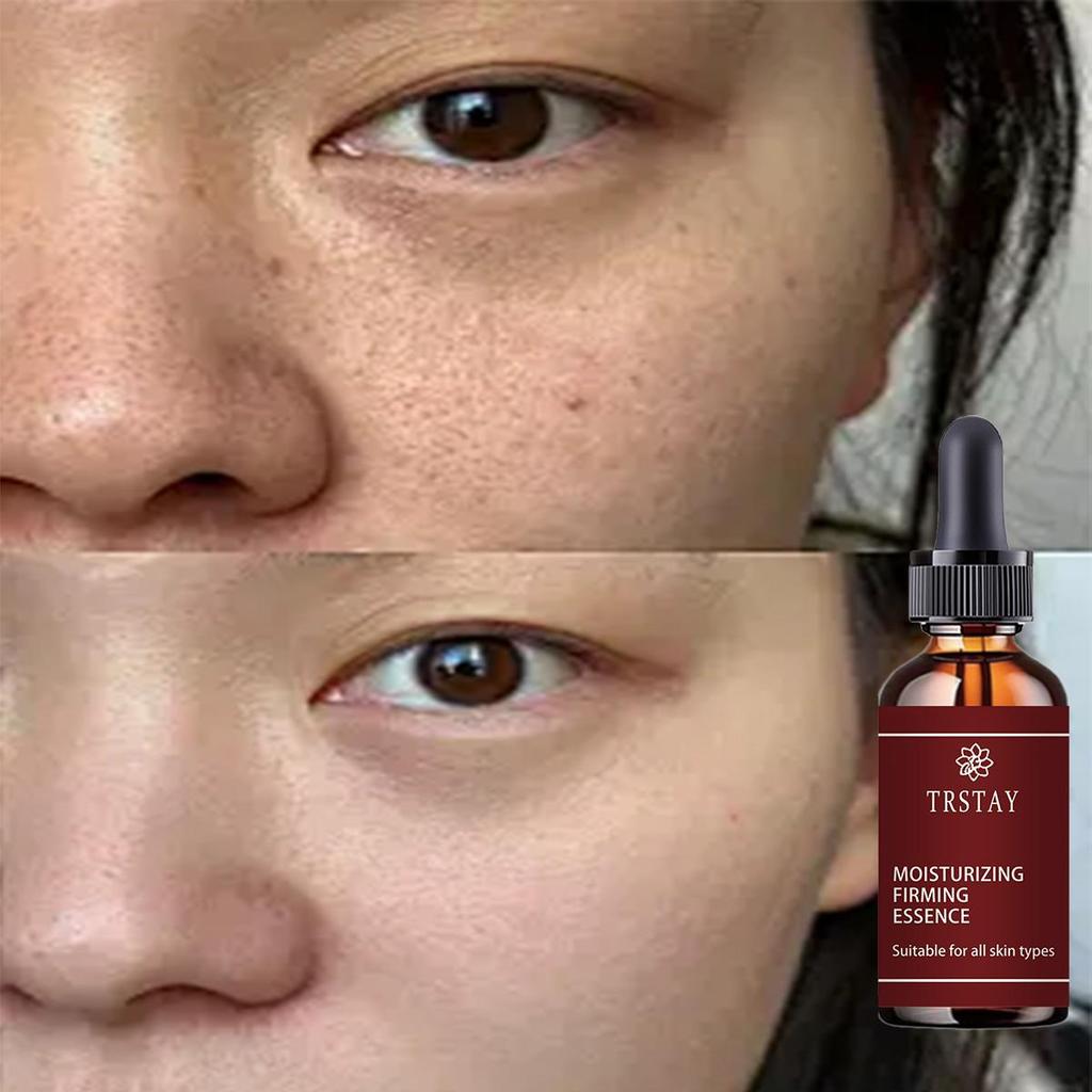 Scar Removing Essence Repairing Skin Whitening Brightening Essential Oil Moisturizing and Hydrating Fluid