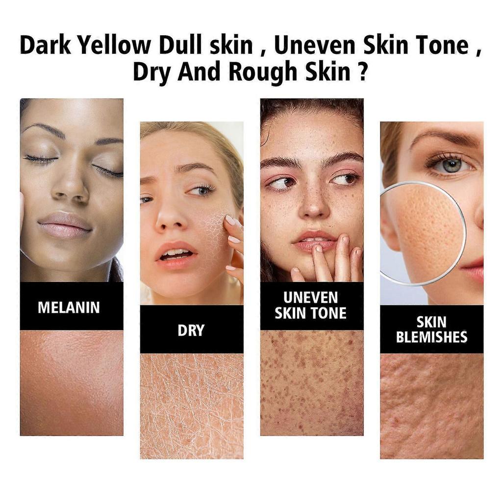 Hoygi Niacinamide Serum - Hydrates And Moisturizes Facial Skin, Firms, Anti-Aging, Reduces Nasolabial Folds And Fine Lines