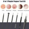 4/6pcs/set Rose Gold Blackhead Needle Set Stainless Steel Pore Cleanser Tool  Beauty Treatment