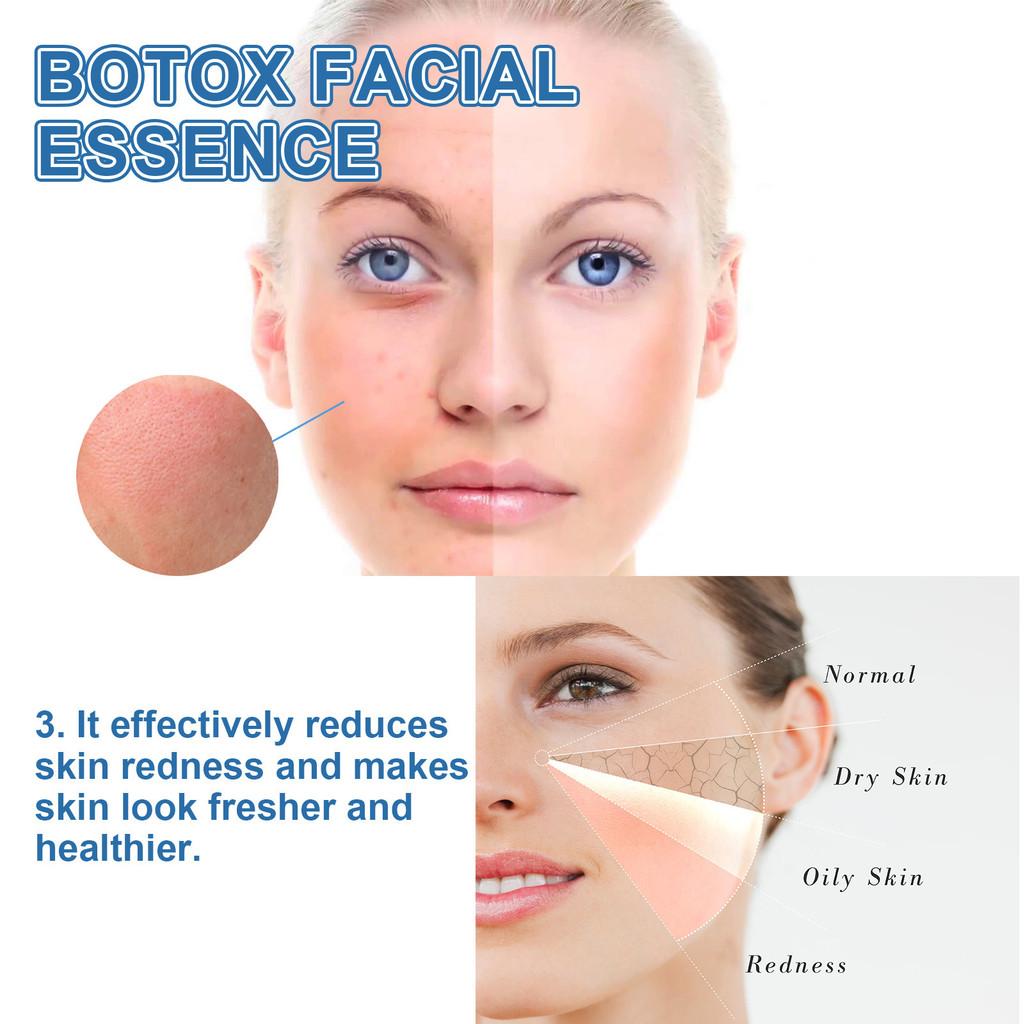 Ouhoe Anti-aging Essence Serum For Youthful Radiant Skin Hydrating Formula 30ml