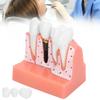 Model zubů Analýza zubního implantátu Demonstrační model korunkového můstku Model zubu