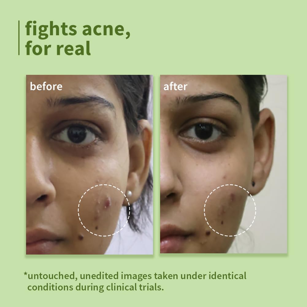 Plum Green Tea Pore Cleansing Face Wash 100ml Pack of 1 | Gentle Exfoliating, Non-Drying, Controls Oil