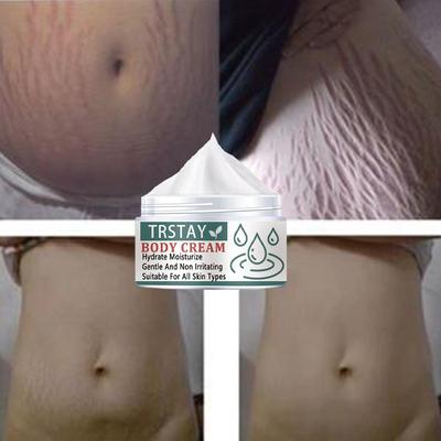 Pregnancy Repair Cream Stretch Mark Removal Removal Acne Scar Stretch Marks Cream Fat Striae Gravidarum Treatment Body Creams