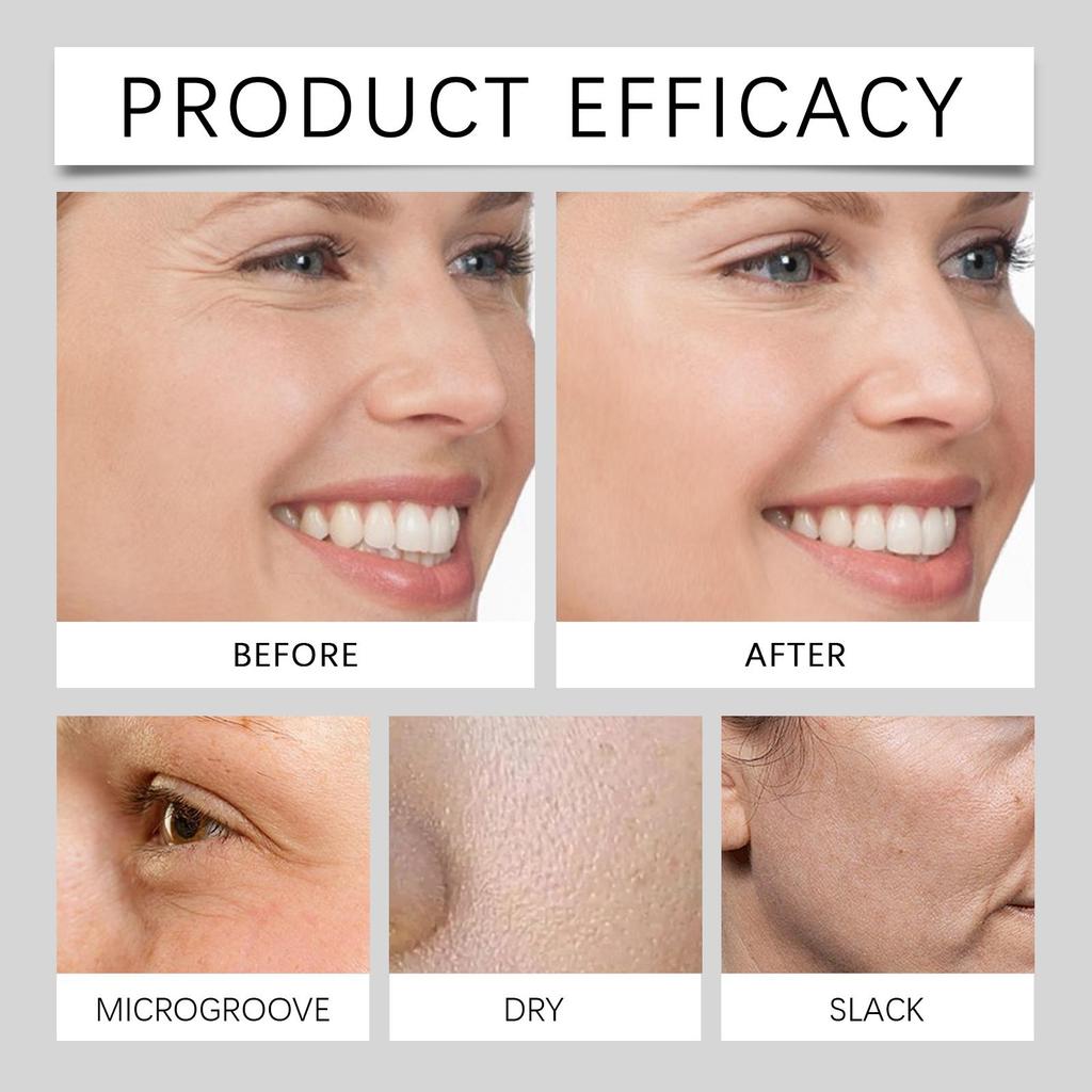 Jaysuing Retinol Moisturizing Cream, hydrating and nourishing, gentle skincare, firming anti-aging, delicate smooth - Women's Gifts