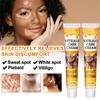 Krém na vitiligo, Přírodní zmírnění vitiliga pro kožní vitiligo, Krém pro péči o vitiligo, Redukuje bílé skvrny a zlepšuje pigmentaci kůže, Snadné použití