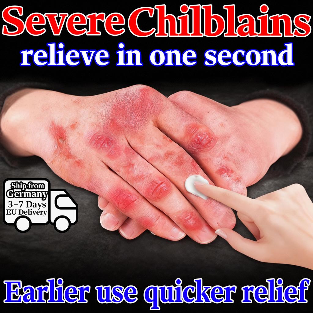 Naturlig örtkräm för torra spruckna händer fötter & köldskador - Skonsam hudvänlig