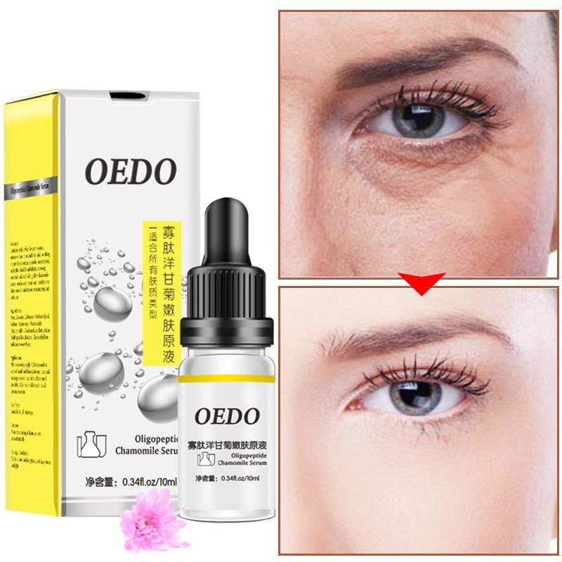 Oligopeptide Chamomile Serum Moistening Whitening Essence Anti Wrinkle Blemish Face Care