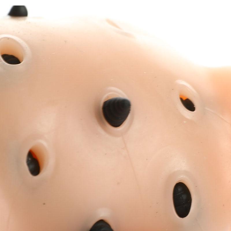 Hračky s černými tečkami, pupínky, vymačkávání akné, úlevu od stresu, hračky, odstraňovače, zastavovací hračky