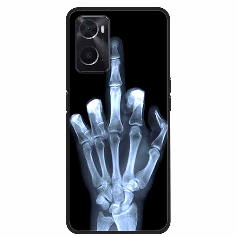 Für OPPO A36 A76 A96 Hülle Stoßfest Weiches Silikon TPU Rückseite für Oppo A76 A 36 96 OppoA96 Handyhüllen für Oppo A76 Niedlich