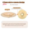 Disposable Ostomy Bags with Skin Stoma Rings Leakproof Barriers Baseplates Activated Carbon Sheet Lining for Safe Daily Use