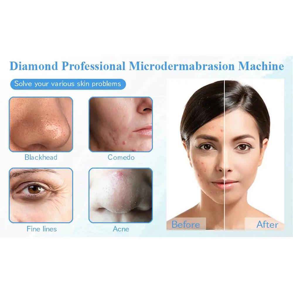 Diamond Microdermabrasion Machine 65-68cmHg Suction Power Professional Home Use Facial Skin Care Dermabrasion Equipment