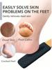 1 Pc Professional Foot File With   Handle, Deep Exfoliating Callus Remover, Home SPA Care, Say Goodbye To Rough Feet