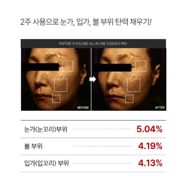 MEDIPEEL Peptide 9 Volume All-in-One Essenz Pro Straffende Anti-Falten & Elastizitäts-Pflege 100ml