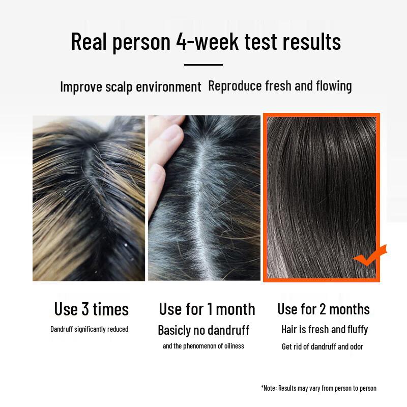 LK Anti-Dandruff & Itch Relief Smoothing Shampoo