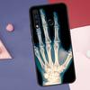 Skeleton Art Case For Huawei Nova 10 9 SE 8i 11i 12i 12s Y60 Y70 Y90 Y72 Y73 Y61 Y91 P60 Pro P30 P40 Lite