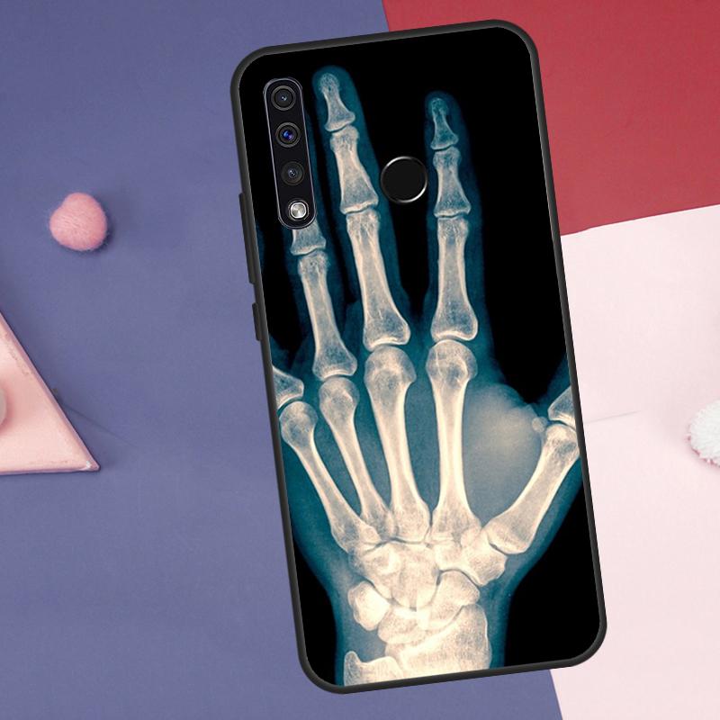 Skeleton Art Case For Huawei Nova 10 9 SE 8i 11i 12i 12s Y60 Y70 Y90 Y72 Y73 Y61 Y91 P60 Pro P30 P40 Lite