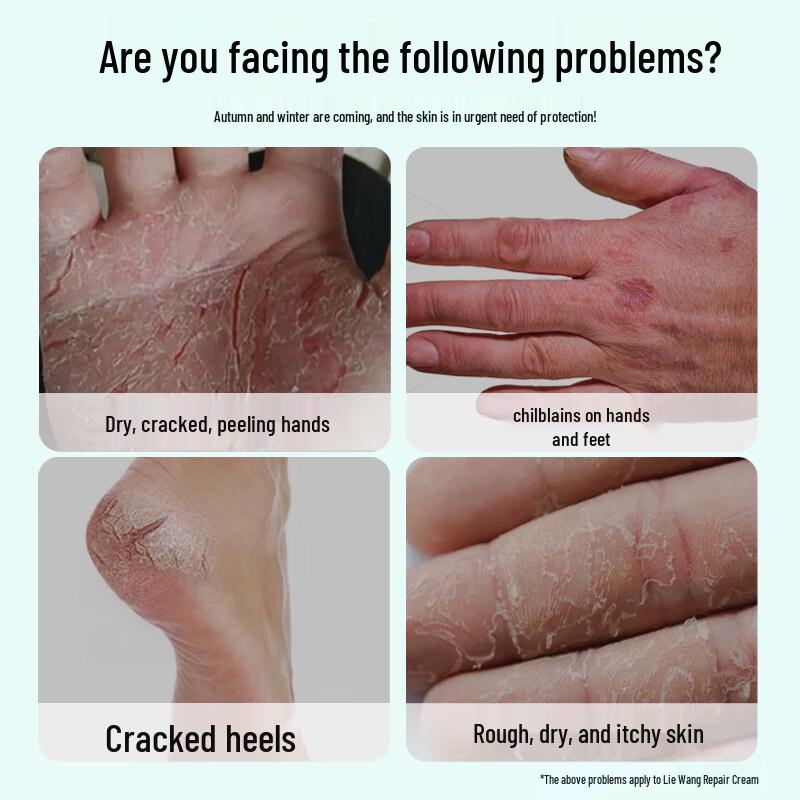 Krem do naprawy popękanej skóry Xin Xile