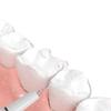 Plaque Remover for Teeth Tartar Remover for Teeth Dental Calculus Remover Teeth Cleaning Kit 3 Adjustable Modes
