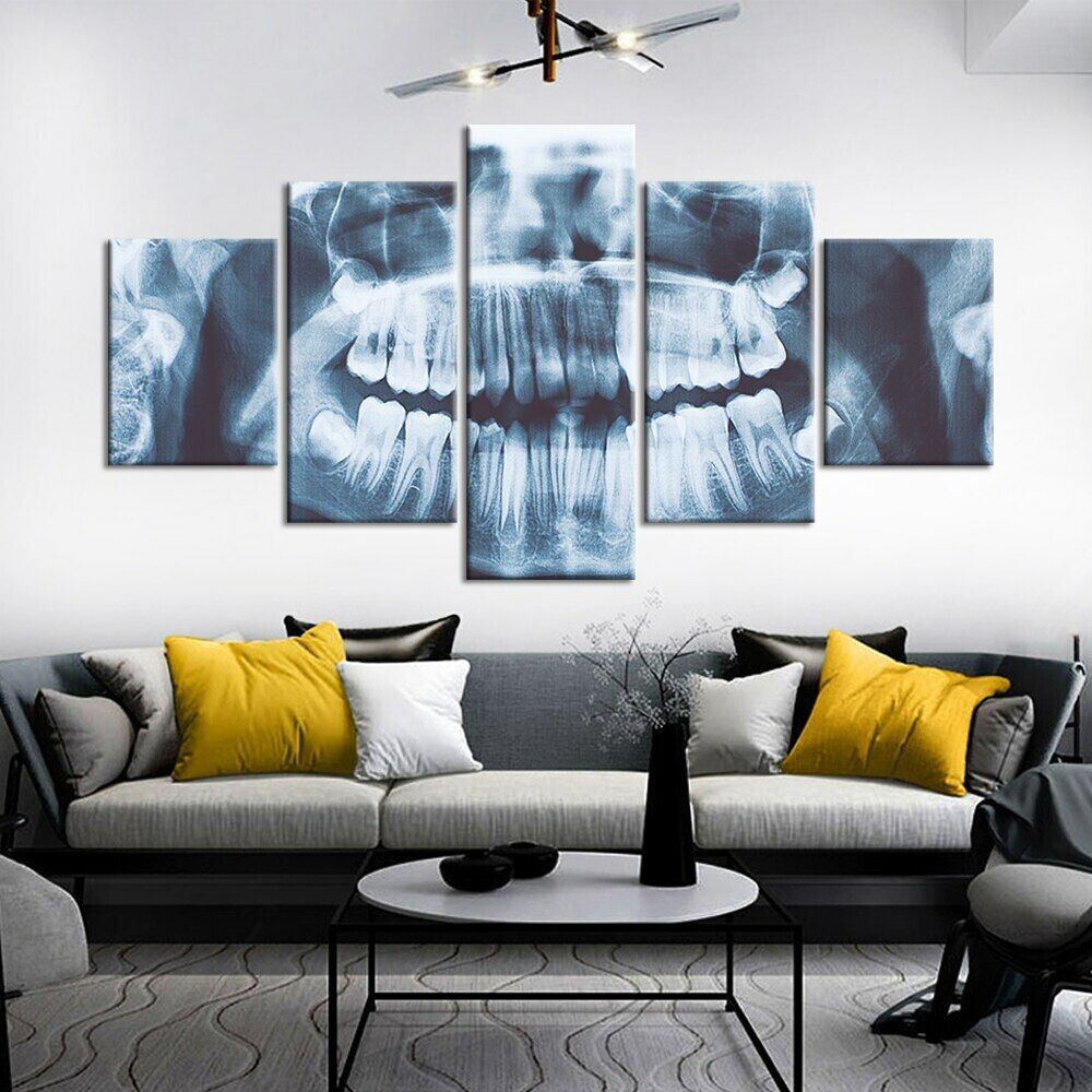 5Pcs Teeth Tooth Xray Dentist Decor 5 Pieces Pictures Wall Poster Home Decor 5 Panel Room Decor Modern Abstract Art No Framed