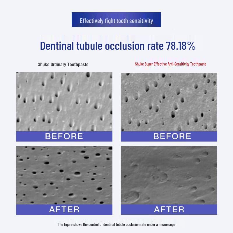 Shuke Anti-Sensitive Whitening Toothpaste 3-Pack