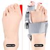1PC Bunion Corrector Unisex Foot Hallux Valgus Braces Rotatable Toe Separator Straightener Adjustable Finger Toe Corrector