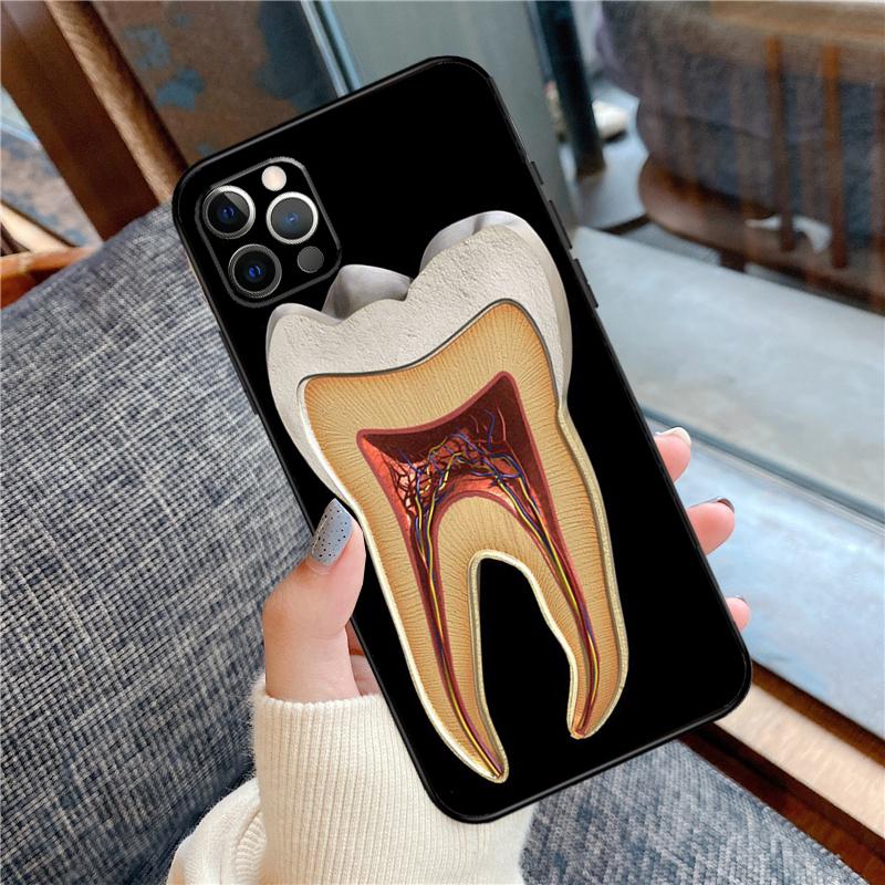 Human Tooth Anatomy Phone Case For iPhone 16 15 14 12 11 13 Pro Max 12 13 Mini XR 15 16 Plus 16e Cover Shell