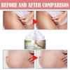 Stretch Mark Cream Pregnant Women Postpartum Stretch Marks  Crema Para Blanquear La Cara Skin Whitening Cream