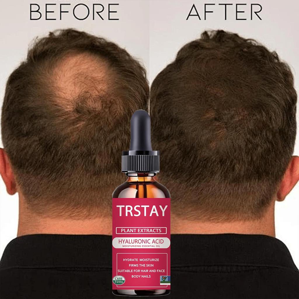 Hair Growth Serum Oil Fast Thick Natural Hair Care Scalp Reconstruction Prevent Hair Loss Damaged Hair Repair Products