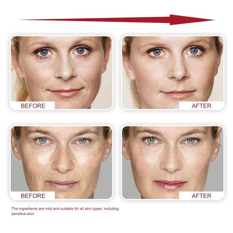 Wiyun Firming Retinol And Brightening Antiwrinkle Cream For Smooth And Skin Youthful