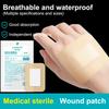 10Pcs Disposable Adhesive Dressing Wound Sterile Skin Colour Breathable Protective Sticker Dressing Healing Patch Self Adhesive
