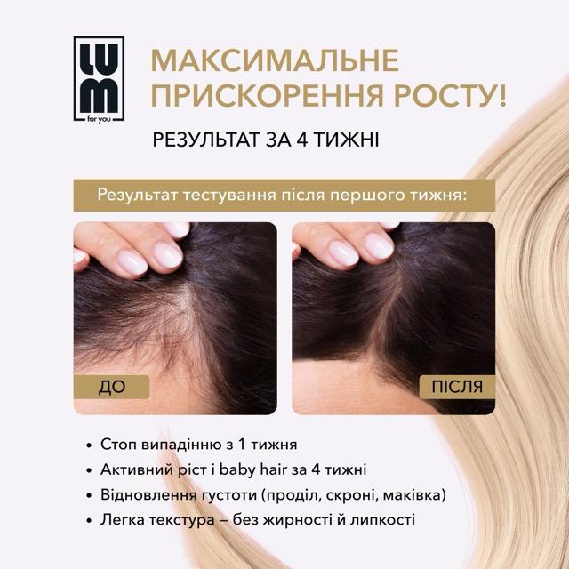 LUM kit "90-day course: follicle activation and density formation"