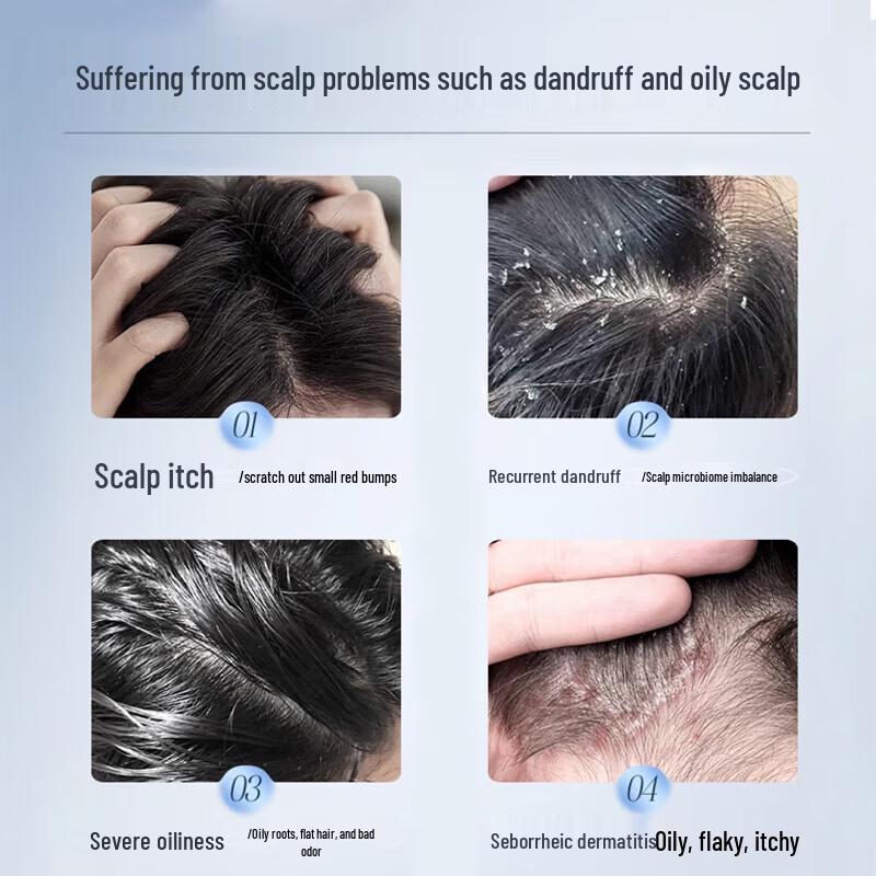 Tong Ren Tang Selenium Disulfide Anti-Dandruff Shampoo