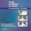 Chest X-Ray A Survival Guide A Survival Guide Paperback