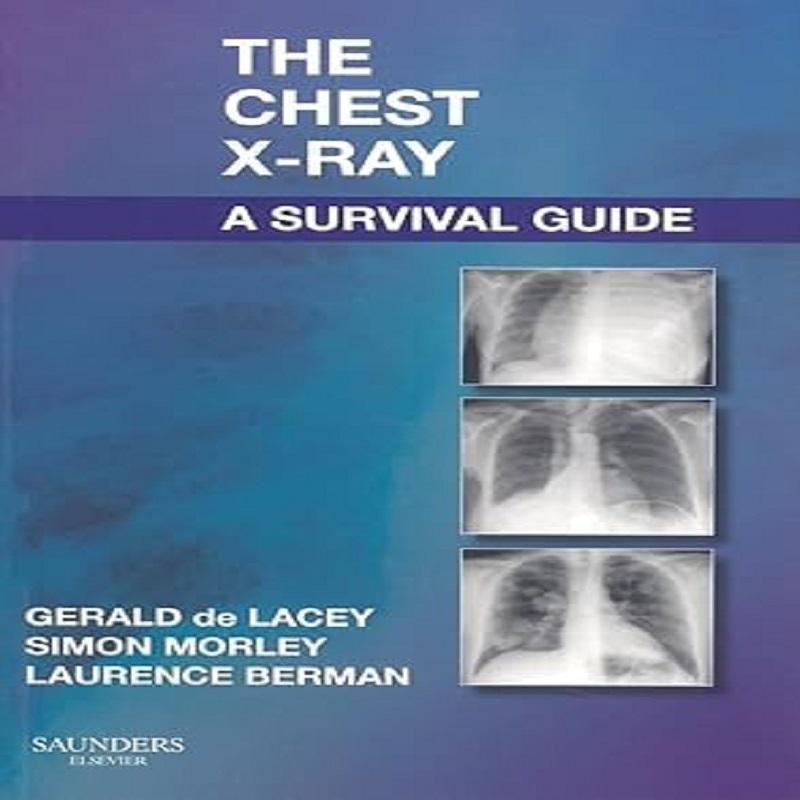 Chest X-Ray A Survival Guide A Survival Guide Paperback