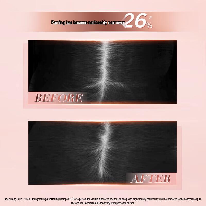L'Oréal Vitality Ginger Anti-Breakage Shampoo & Conditioner Set