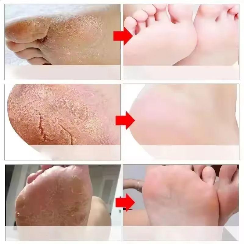 Crack Resistant Foot Cream, Heel Crack Repair Cream, Removes Dead Skin and Keratin, Softens, Moisturizes and Smooths Skin Care