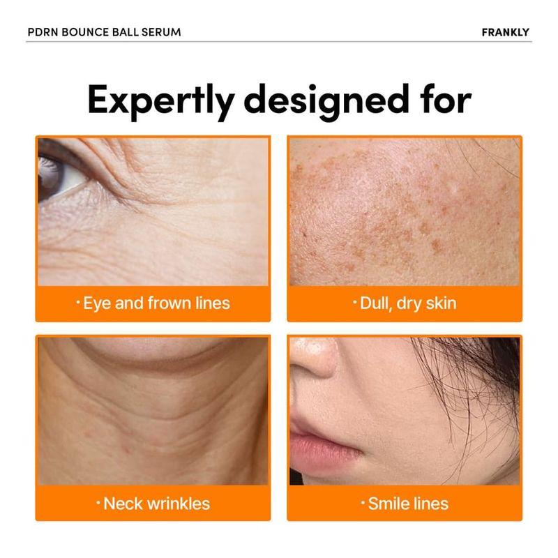 FRANKLY - PDRN Bounce Ball Serum