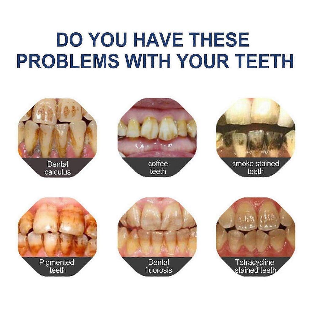 Jaysuing Teeth Whitening Paint: Remove Stains, Whiten Teeth, Oral Cleansing