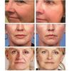 Wrinkle Remover Face Serum Lift Anti-aging Fade Fine Lines Moisturizing Essence