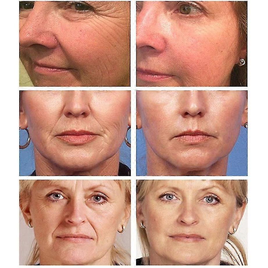 Wrinkle Remover Face Serum Lift Anti-aging Fade Fine Lines Moisturizing Essence