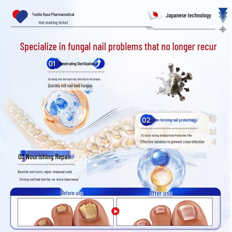 Fungal Nail Treatment Liquid