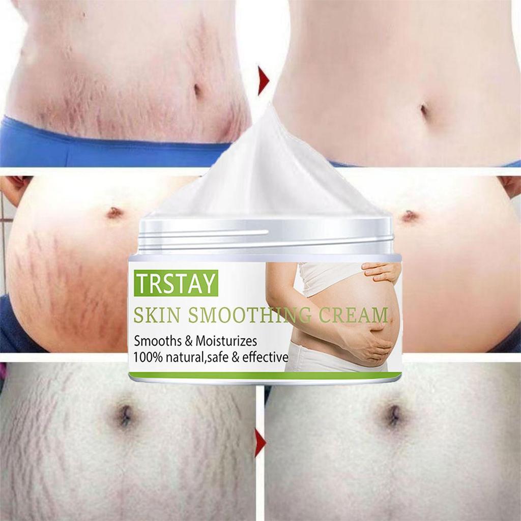 Stretch Mark Cream Pregnant Women Postpartum Stretch Marks  Crema Para Blanquear La Cara Skin Whitening Cream
