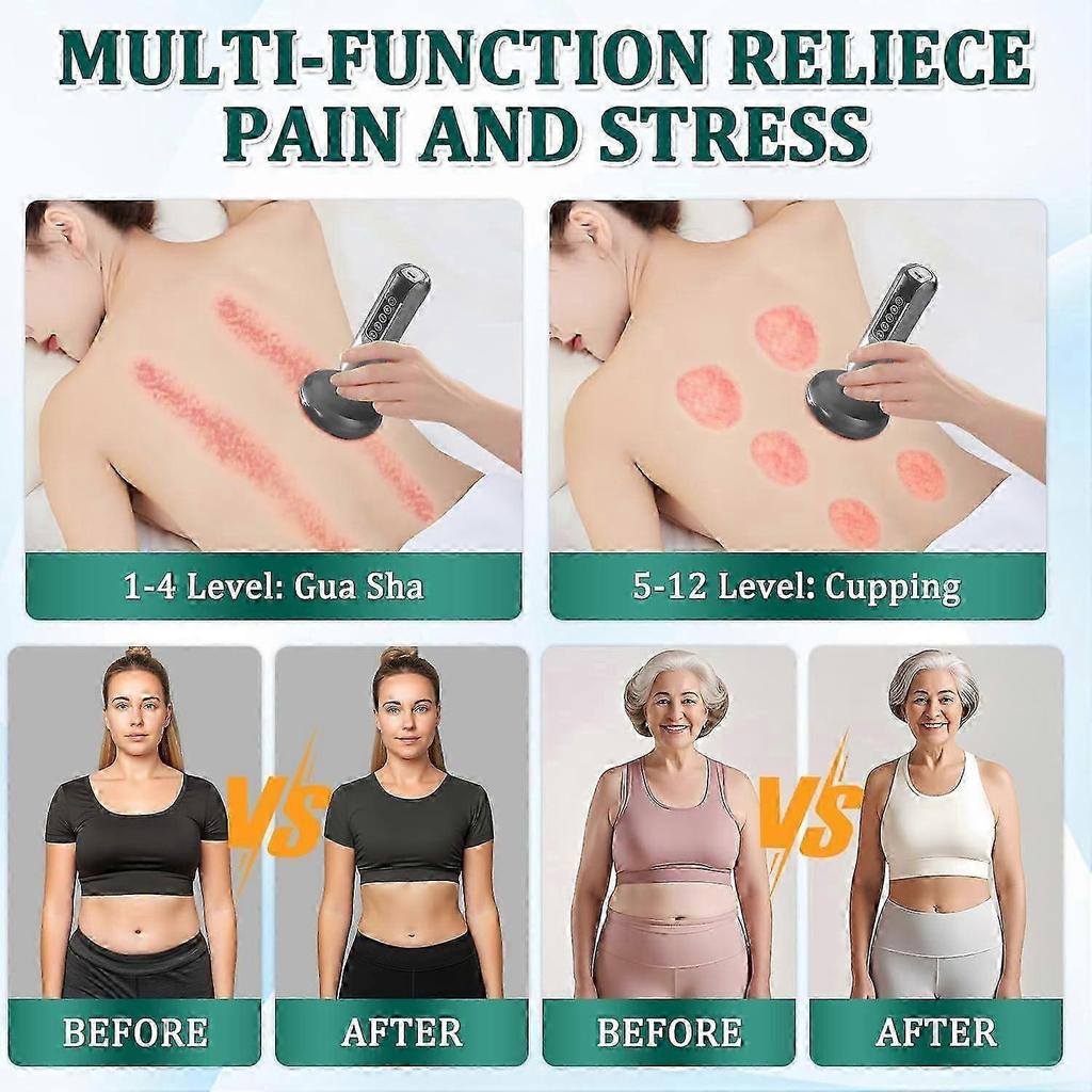 Cellulite Massager, 12 Gear Adjustable Body Sculpting Cellulite Machine, Smart Electric Suction Cupping Therapy Set, Rechargeable