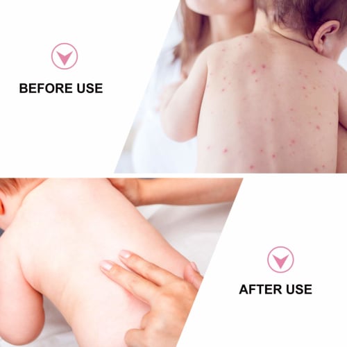 SMASOLO 3-Piece Baby Powder Puff, Large, Fluffy Powder Puff for Pug Hair, Pink, for Toddlers, Gentle On Skin, Lightweight, Body Powder, Versatile