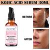 Multifunctional Facial Serum with Kojic Acid, Arbutin and Glutathione Dark Skin Whitening and Dark Spot Brightening 30ml