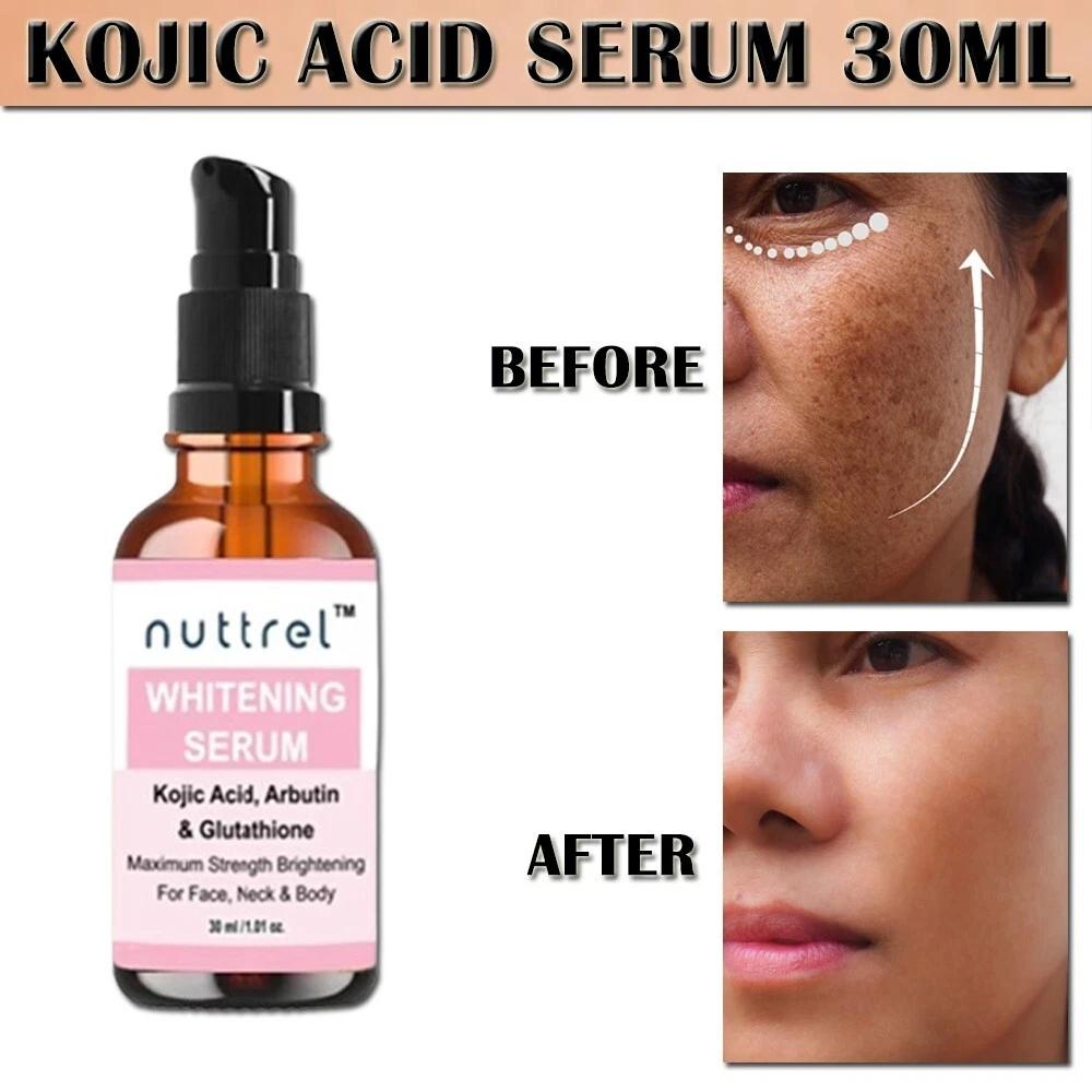 Multifunctional Facial Serum with Kojic Acid, Arbutin and Glutathione Dark Skin Whitening and Dark Spot Brightening 30ml