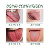 2pcs Tongue Repair Spray, Mouth Odor Eliminator & Instant Dry Mouth Relief, Fissured Tongue Relief Spray Bad Breath Eliminator