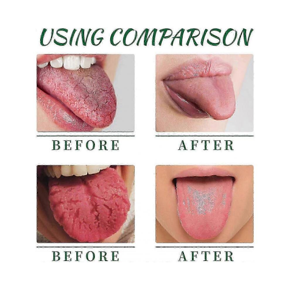 2pcs Tongue Repair Spray, Mouth Odor Eliminator & Instant Dry Mouth Relief, Fissured Tongue Relief Spray Bad Breath Eliminator